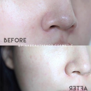 Tẩy da chết Cosrx BHA