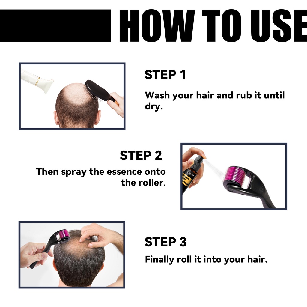 Tinh chất xịt Kopyrrol kích thích mọc tóc cải thiện chăm sóc da đầu 30ml