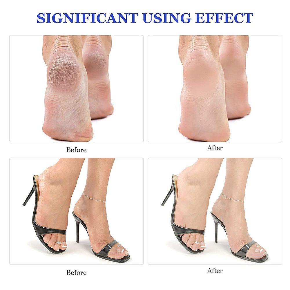 Xiantin 1pc Pumice|1 Dụng Cụ Tách Hạt Bắp