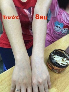 Tẩy tế bào chết Quế hồi