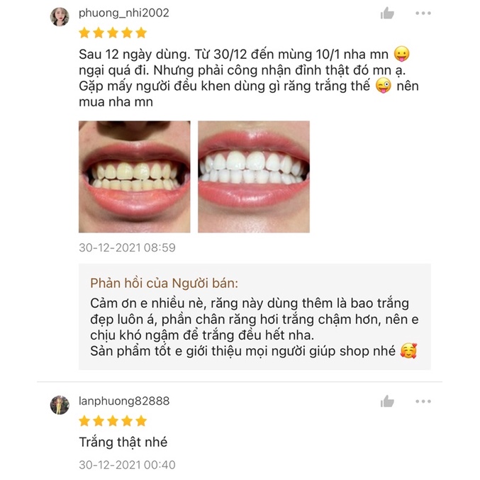 Máy làm trắng răng CONG FANSDR, tẩy trắng răng tại nhà hiệu quả, không ê buốt
