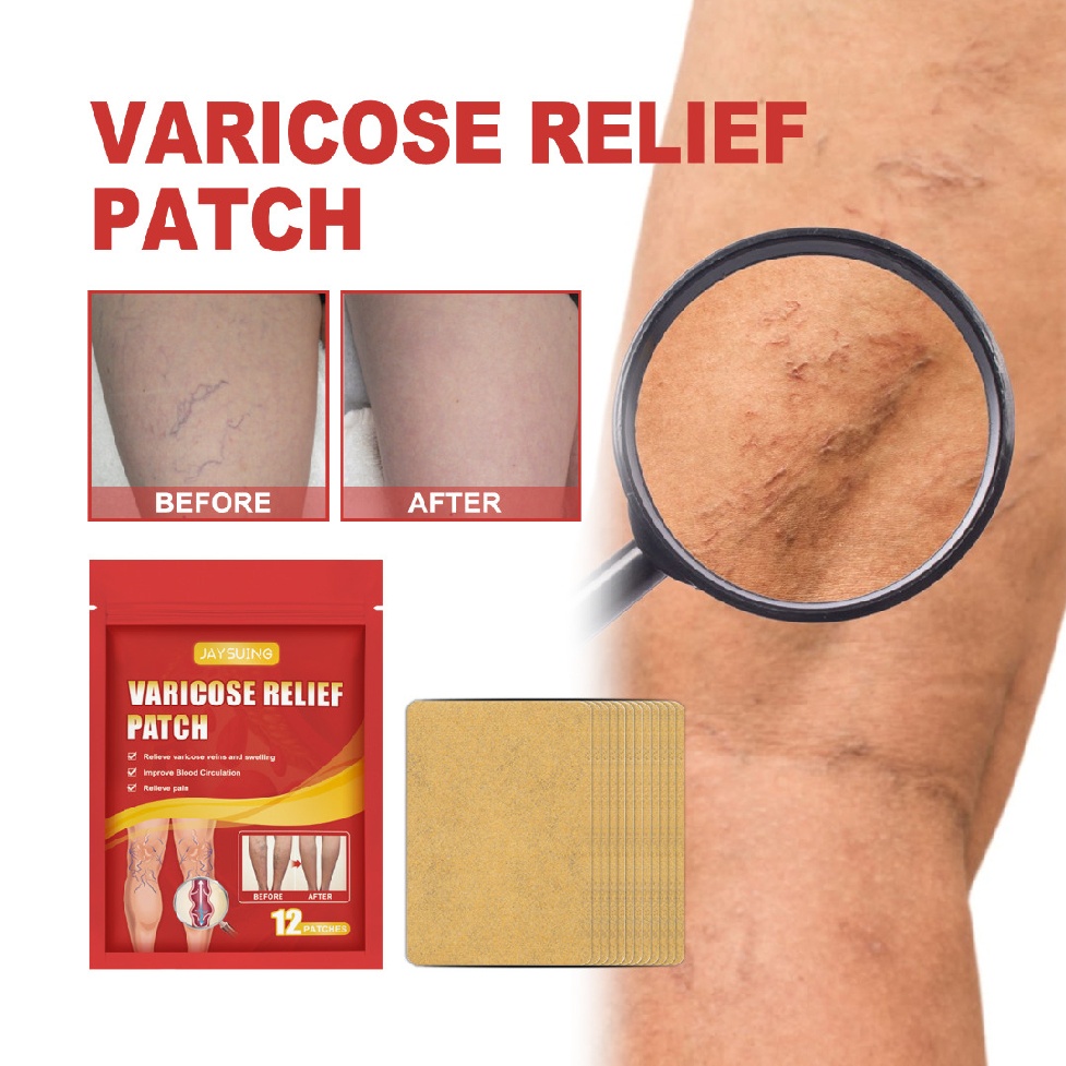 [Hàng mới về] Set 12 miếng dán giảm giãn tĩnh mạch chân nhện