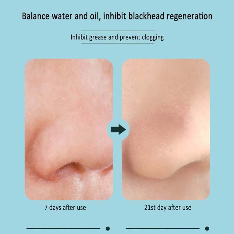 Miếng dán mũi RNW lột mụn đầu đen hai bước