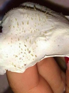 Gel hút mụn bạc hà