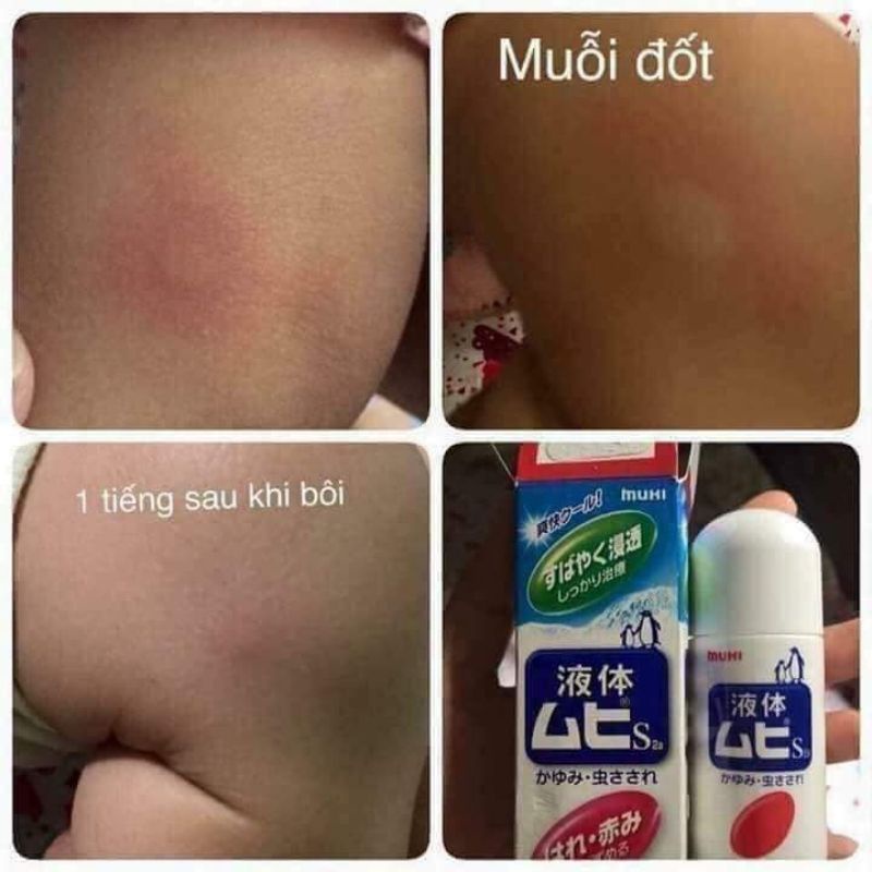 Lăn Bôi Muỗi Đốt Và Côn Trùng Cắn Muhi Nhật Bản 50ml nội địa chính hãng