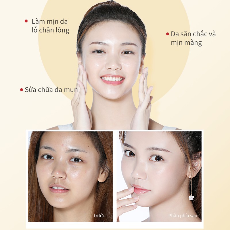 Tinh Chất BAIMISS Dòng Pore Refining 30ml