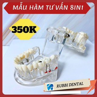 [ CHÍNH HÃNG ] MẪU HÀM TƯ VẤN 8IN1 - ĐẦY ĐỦ CÁC BỆNH LÝ CẦN THIẾT TRONG NHA KHOA. PHÒNG KHÁM NÀO CŨNG CẦN CÓ. HÀNG CHUẨN