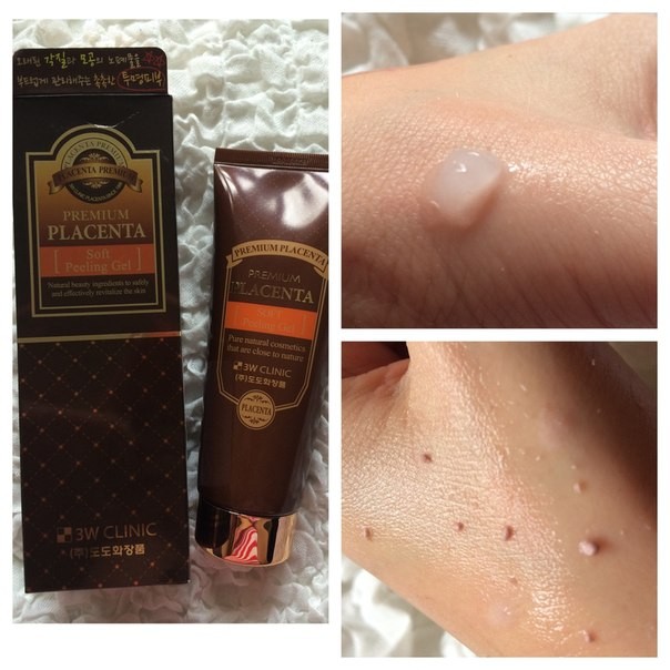 Kem Tẩy Tế Bào Chết 3W Clinic Premium Placenta Soft Peeling Gel 160ml | BigBuy360 - bigbuy360.vn