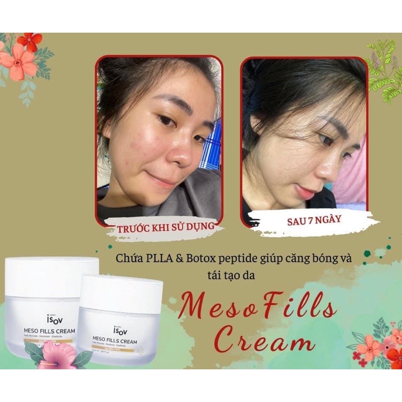 MESO FILLS CREAM - Kem Chứa PLLA & Botox Giúp Tái Tạo Và Căng Bóng Da