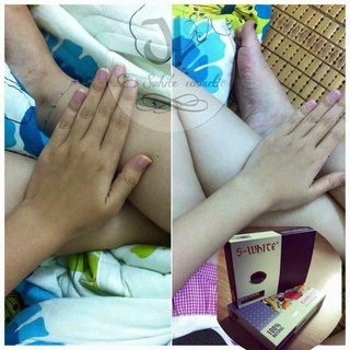 Tắm Trắng Cà Phê S-White Bật Tone Nhanh