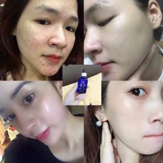 Serum Ha 30ml