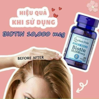 Viên uống mọc tóc Biotin 1000mcg (100 viên)