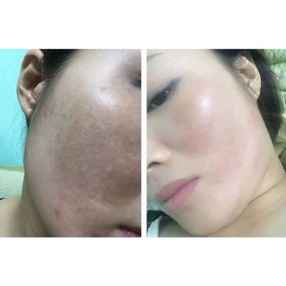 Tinh dầu gấc 450k/10ml