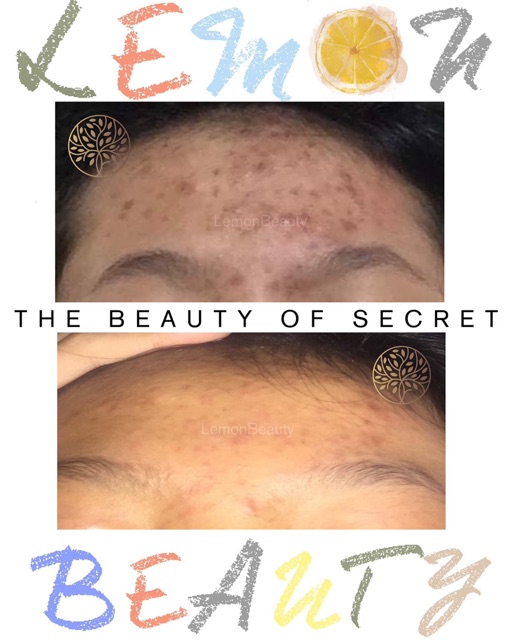 [MUA 1 TẶNG 4] - LEMON MASK KHỔ QUA RỪNG | BigBuy360 - bigbuy360.vn