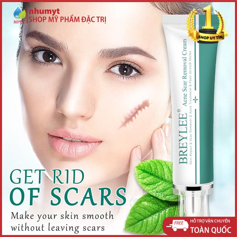 Kem mờ sẹo làm trắng da, mờ thâm sẹo | BigBuy360 - bigbuy360.vn