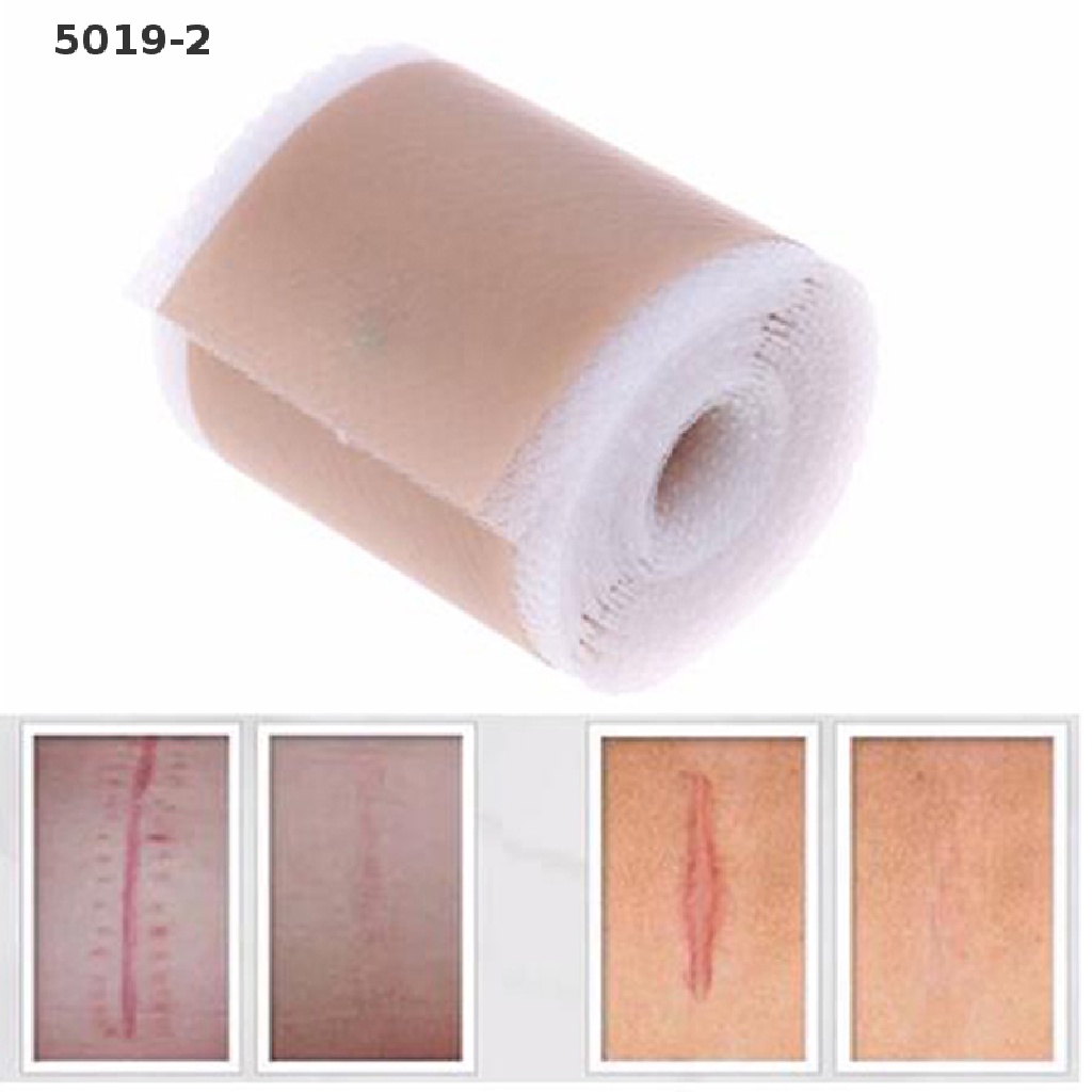 Keo Phục Hồi Da Bằng silicone Tiện Lợi