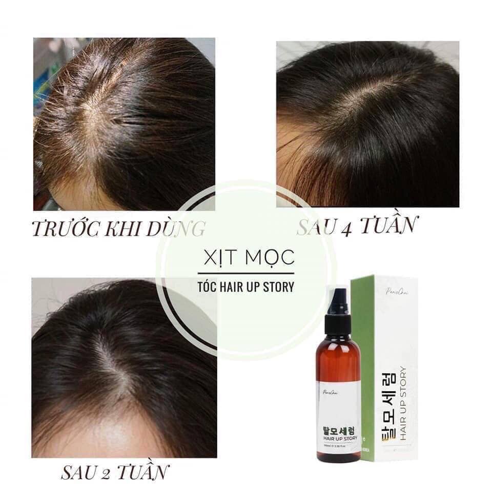 Tinh chất mọc tóc Genie Paris Choi Hair Up Story