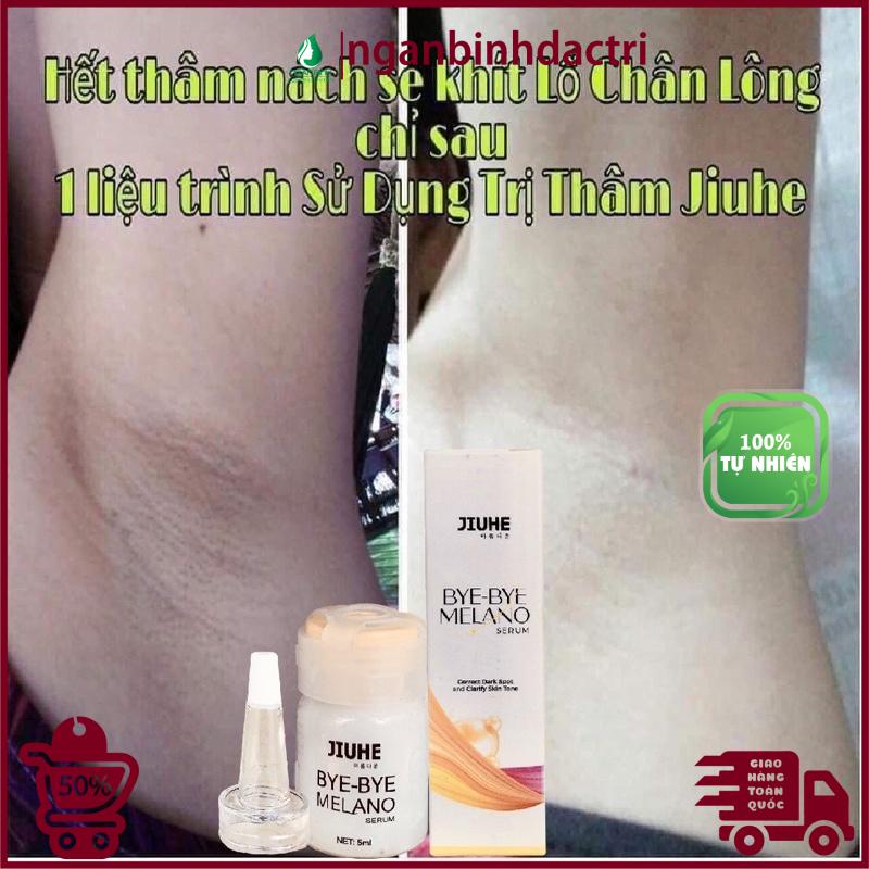 Serum tri thâm hàn quốc JIUHE Q-PEARL giảm thâm do mụn khửu tay chân, thâm sẹo, thâm nách hiệu quả