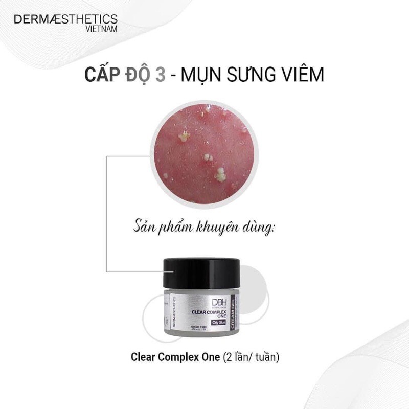 Kem ngừa mụn giảm mụn hiệu quả dưỡng da mụn DBH Clear Complex one