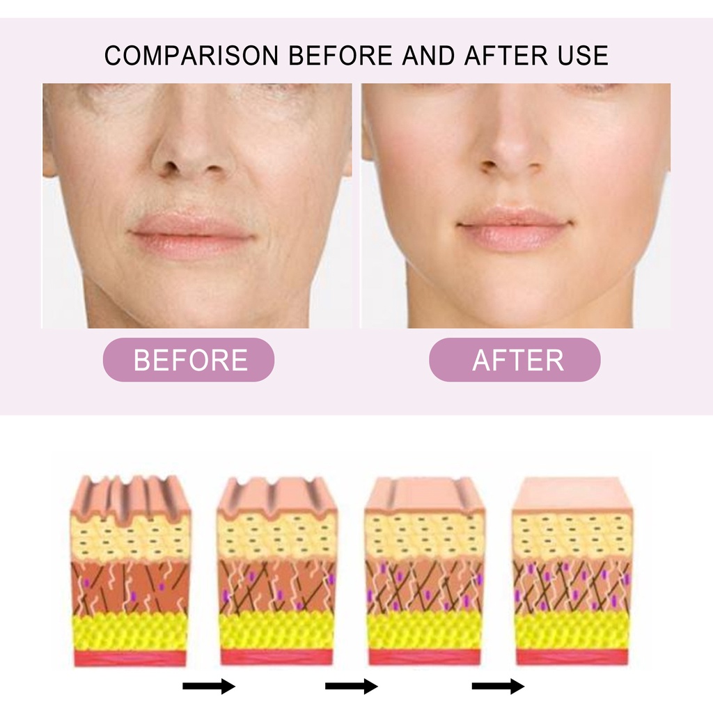 Serum Ceramide Chuyên Nghiệp Dưỡng Ẩm Chống Nếp Nhăn