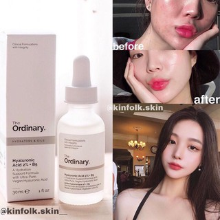 [Có ảnh BILL ] Serum The Ordinary HA 2% + B5