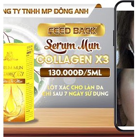 Serum Mụn Collagen X3 Luxury mỹ phẩm Đông Anh Chính Hãng