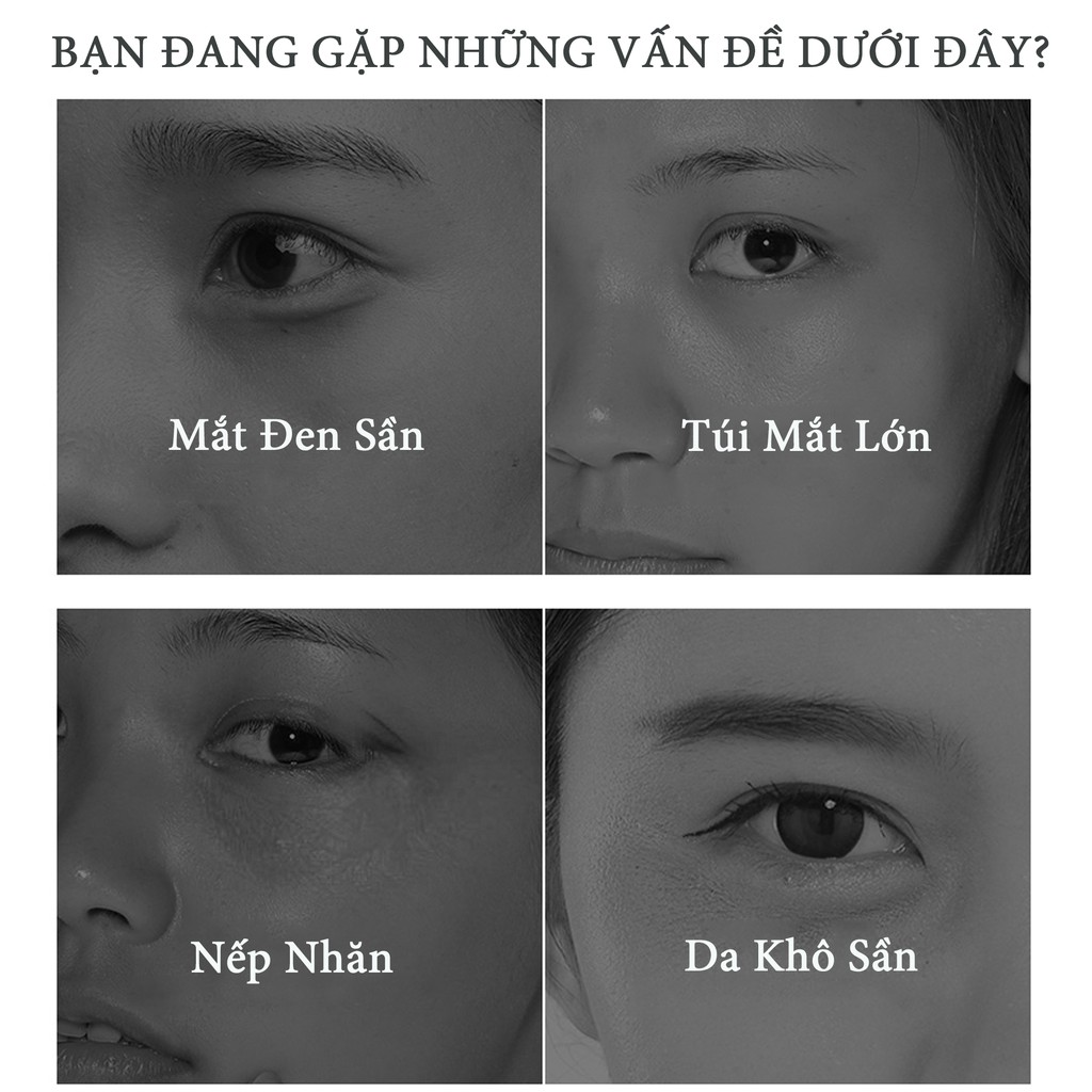  MẶT NẠ DƯỠNG MẮT NGỌC TRAI BAIMISS CHỐNG THÂM QUẦNG MẮT 6g x 30 miếng BMYR41