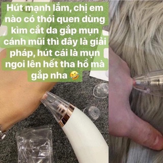 [Hàng chuẩn] Hút mụn