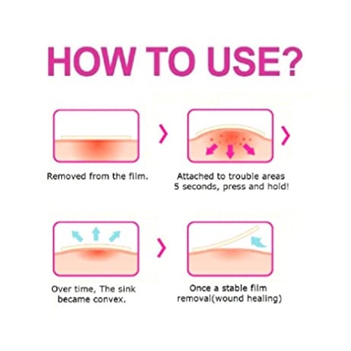 Miếng Dán Hỗ trợ giảm mụn Olive Young Careplus