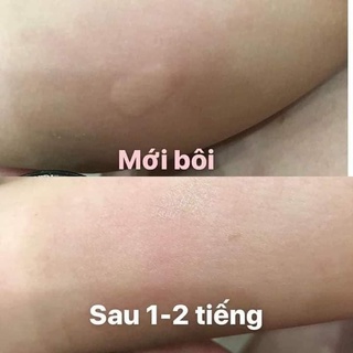 [Hàng_xách_tay_Thái] Cao Bôi Muỗi Đốt,Côn trùng Cắn Thái Lan