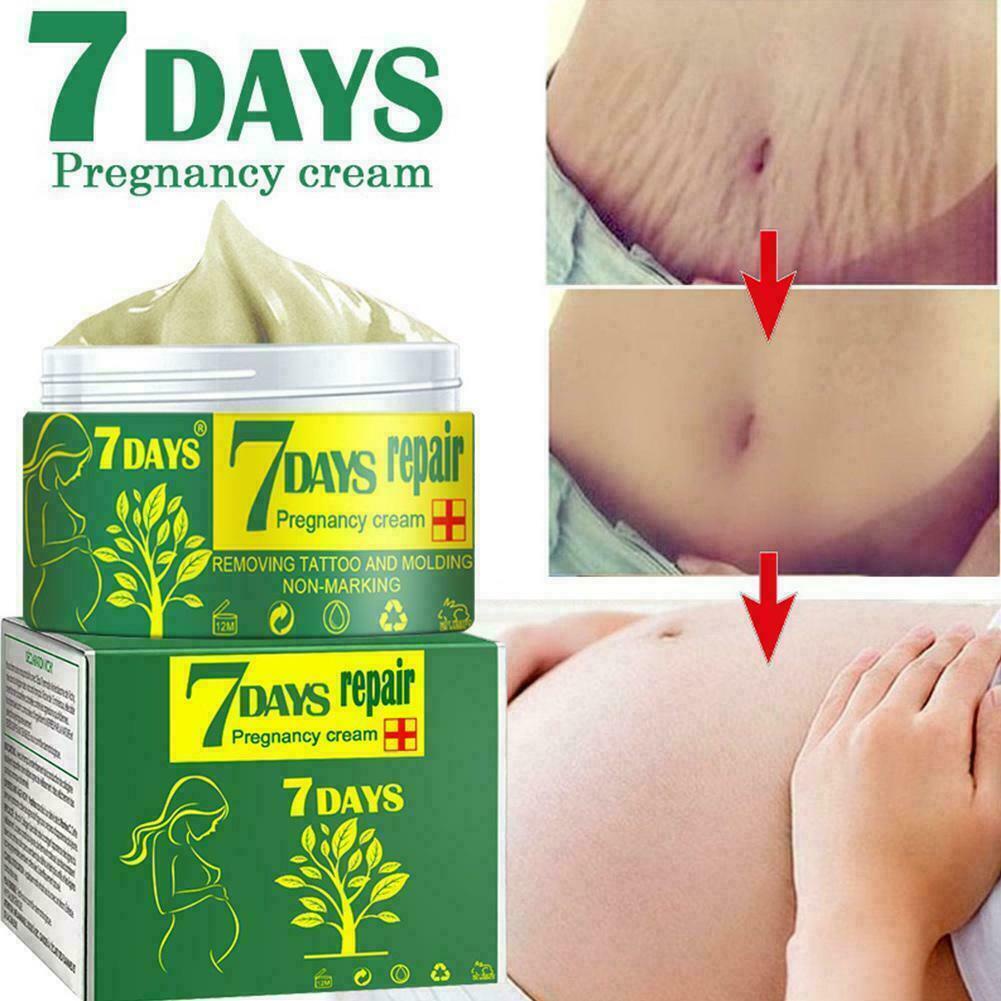 [Hàng mới về] Kem phục hồi vết rạn da tiện dụng cho vùng bụng Q1Q6 C4V4