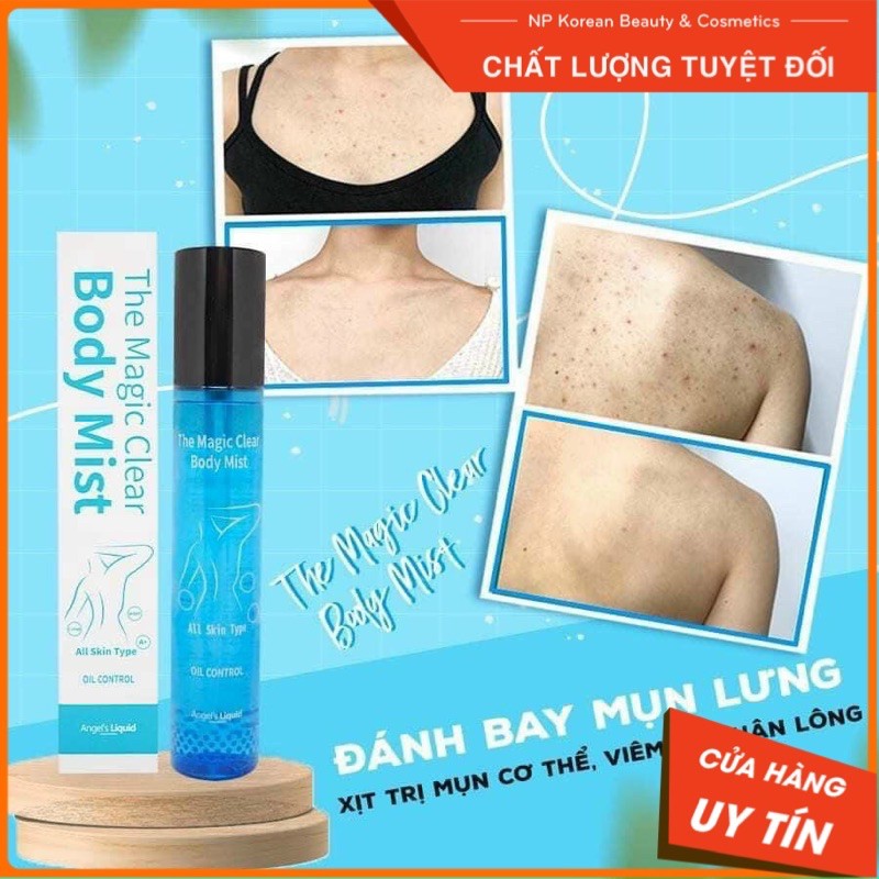 [SIÊU HOT] XỊT TẨY MỤN LƯNG BODY MIST | BigBuy360 - bigbuy360.vn