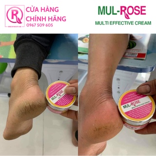Combo 5 Kem đa năng MUL-ROSE