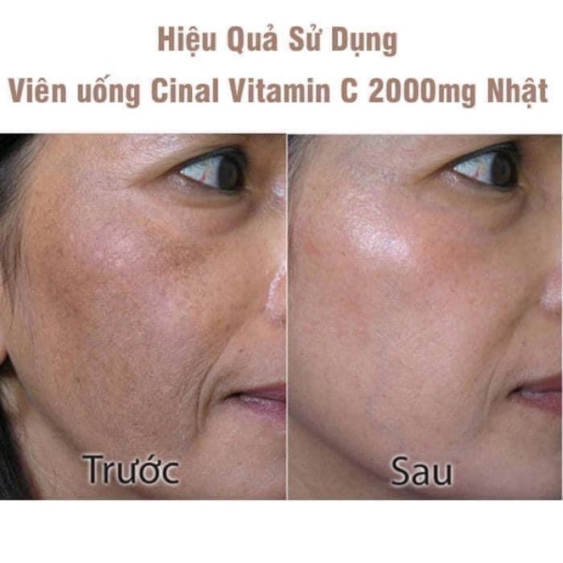 Viên Uống Cinal C Vitamin C - 100 viên Nhật Bản
