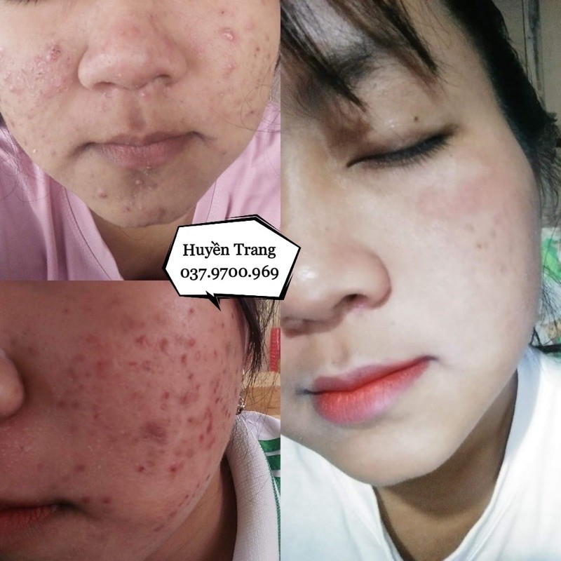 THUỐC BẮC TÁI TẠO DA (HANDMADE) 125ml | BigBuy360 - bigbuy360.vn