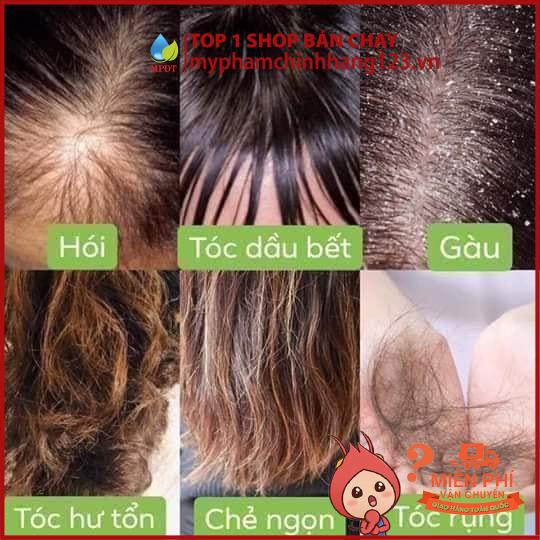 ( Combo 3sp ) DẦU GỘI BỒ KẾT CÔ ĐẶC + TINH DẦU BƯỞI + DẦU XẢ SỮA DỪA kích thích mọc tóc, làm mềm mượt tóc , ...