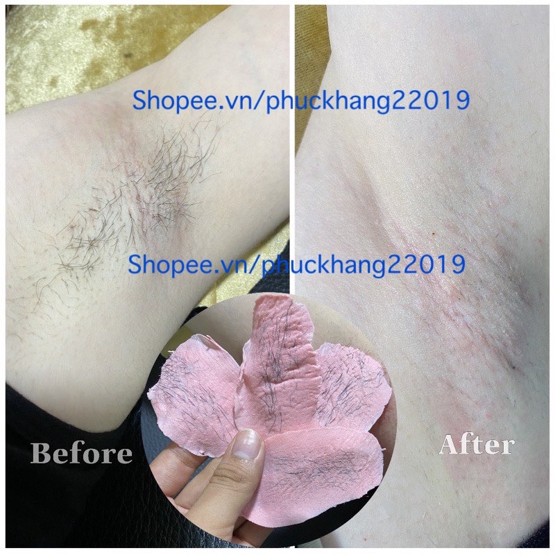 Sáp wax lông nóng hạt đậu nhập khẩu, sáp waxing hard wax beans triệt lông tay, chân, nách | BigBuy360 - bigbuy360.vn