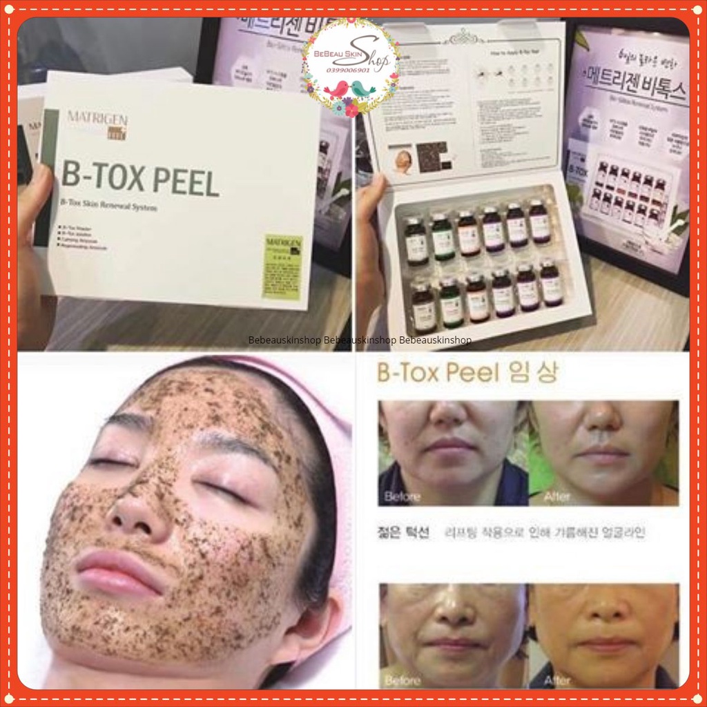 Matrigen B-Tox Peel Thay Da Sinh Học Vi Tảo Hàn Quốc | BigBuy360 - bigbuy360.vn