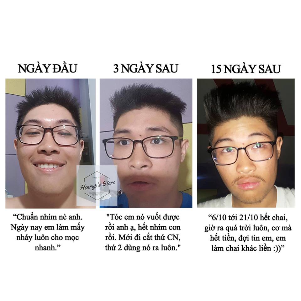 SIÊU DƯỠNG TÓC HAIR ON FLEEK | BigBuy360 - bigbuy360.vn