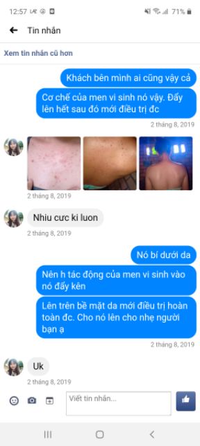 COMBO MEN VI SINH TAVIDA VÀ SOAP NGHỆ DỨT ĐIỂM VIÊM NANG LÔNG, MỤN LƯNG, NGỰC | BigBuy360 - bigbuy360.vn