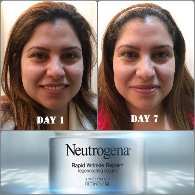 Kem Dưỡng Da Chống Lão Hóa Neutrogena Rapid Wrinkle Repair Regenerating Cream (48g) _ NTG010DD