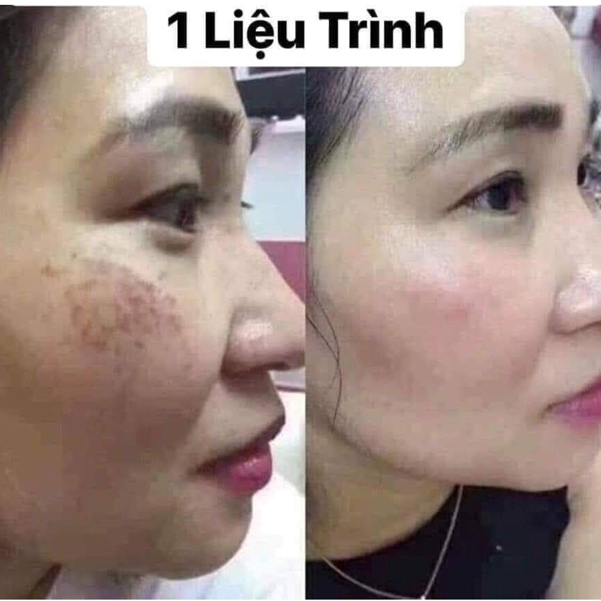Viên Uống NiNe's Beauty Trắng Da - Mờ Nám - Giảm Nếp Nhăn | Thế Giới Skin Care