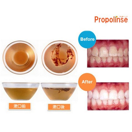 Nước súc miệng của Nhật Bản Propolinse Chính hãng