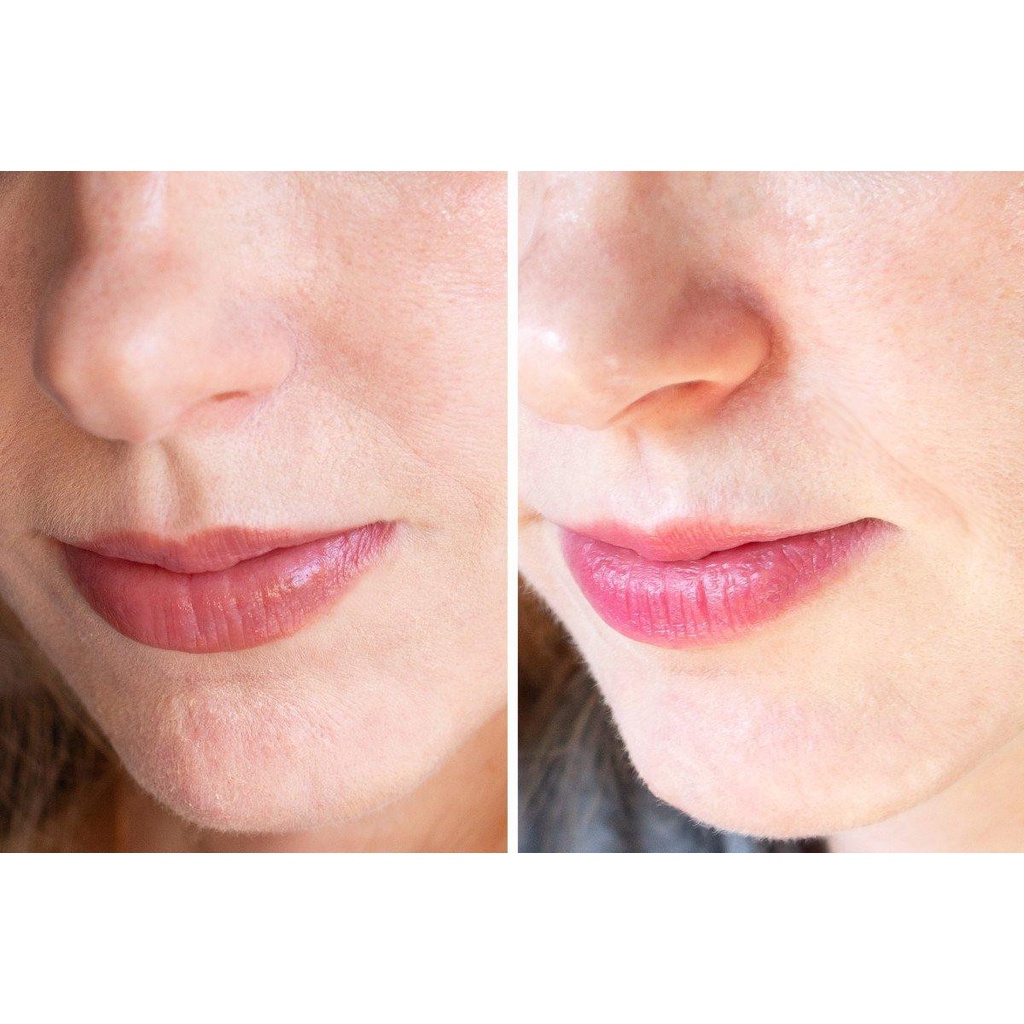 Date 4/2023] Kem Ngừa Mụn Chống Lão Hóa Giảm Nếp Nhăn PHARMA Developpement A313 Pommade Retinol Cream 50g