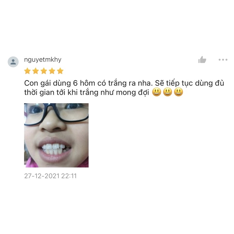 Máy làm trắng răng CONG FANSDR, tẩy trắng răng tại nhà hiệu quả, không ê buốt
