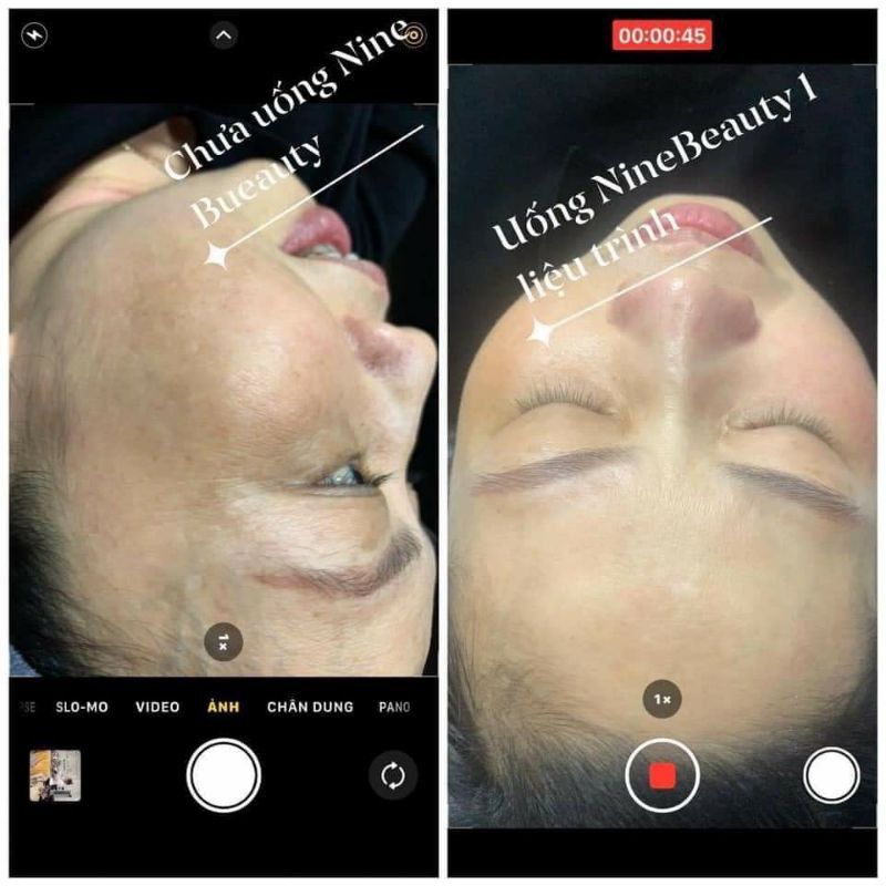 [CHÍNH HÃNG]Viên Uống Trắng Da NINE'S BEAUTY | BigBuy360 - bigbuy360.vn