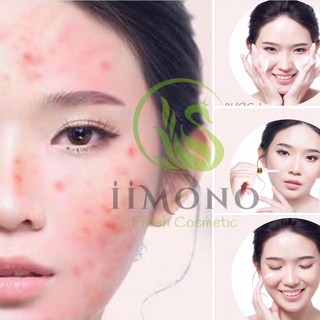 Combo 3 hộp tinh chất mụn IIMONO 20ml