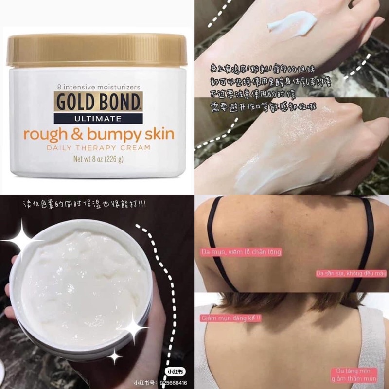 SẴN KEM CỔ KEM MÔNG BOLD BOND