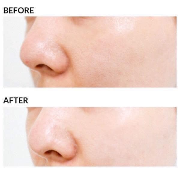 [CHÍNH HÃNG] Sample Tinh Chất Dưỡng Trắng Da, Se Lỗ Chân Lông Innisfree Whitening Pore Serum