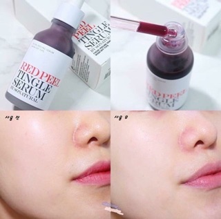 Red Peel Tingle Serum